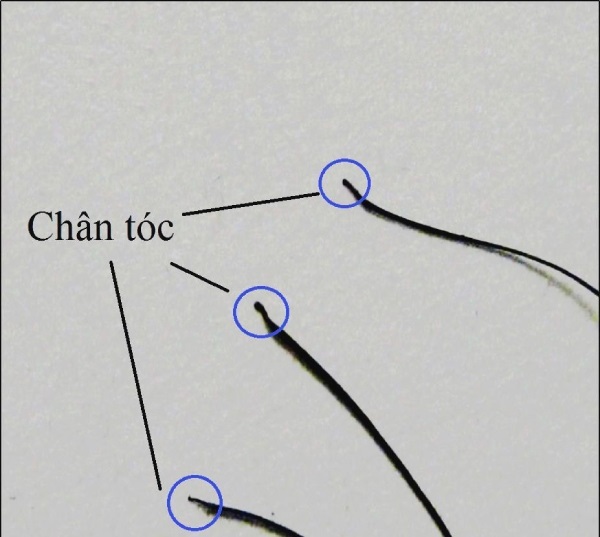 Xét nghiệm ADN bằng tóc